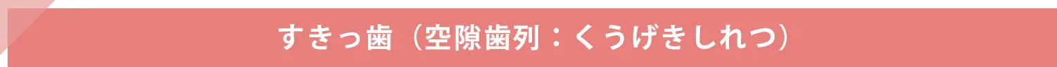 空隙歯列