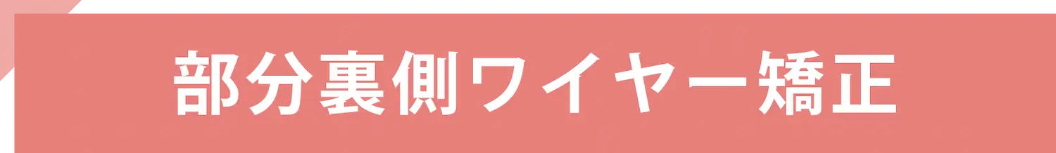 部分裏側ワイヤー矯正