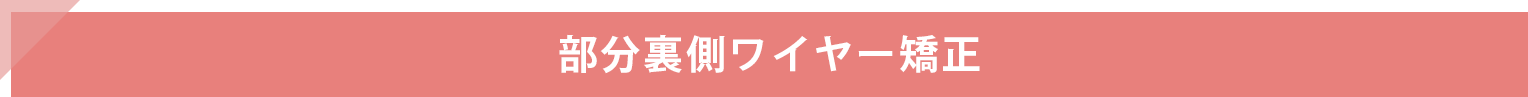 部分裏側ワイヤー矯正