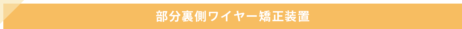 部分裏側ワイヤー矯正装置