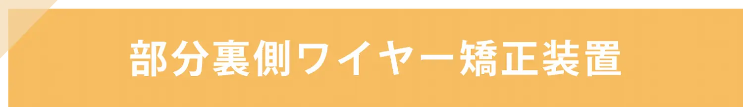 部分裏側ワイヤー矯正装置