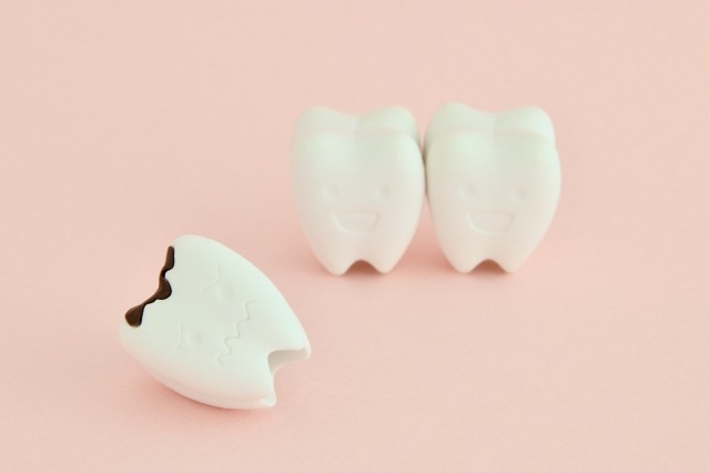矯正治療中できる虫歯のイメージ画像
