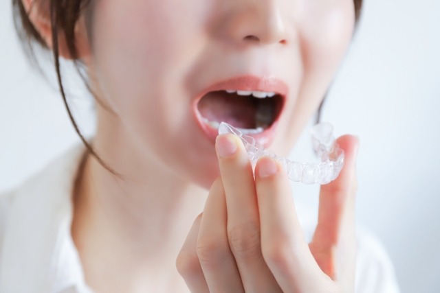 マウスピース型矯正装置を装着する女性の画像