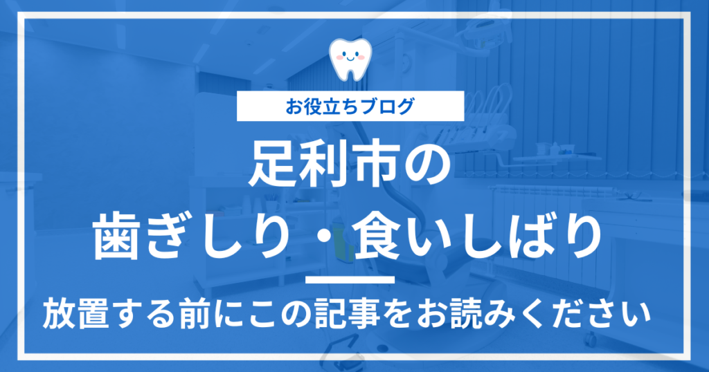 足利市の歯ぎしり・食いしばり治療を解説した記事のアイキャッチ画像